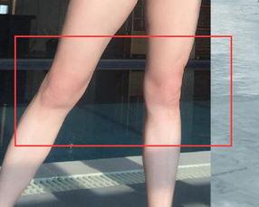 变形腿图片,揭秘人体奇观背后的科学奥秘